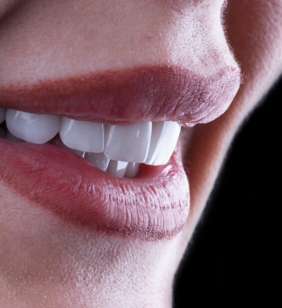 Closeup of smile with metal free dental crowns
